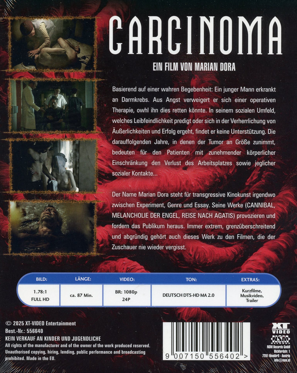 Carcinoma - Uncut Edition  (blu-ray)