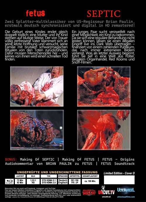 Fetus + Septic - Uncut Mediabook Edition  (blu-ray) (D)