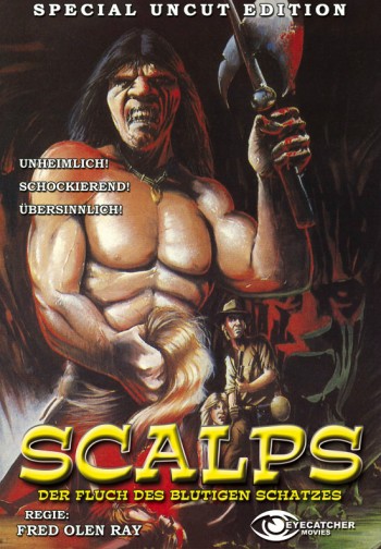 Scalps –