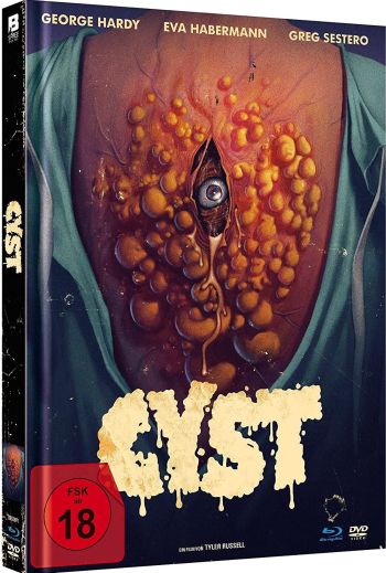 Cyst - Uncut Mediabook Edition (DVD+blu-ray)